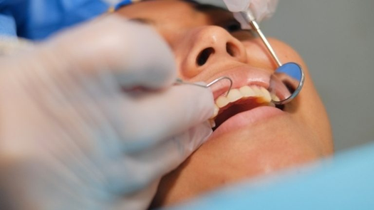 Salud bucal en la adultez: clave para prevenir enfermedades