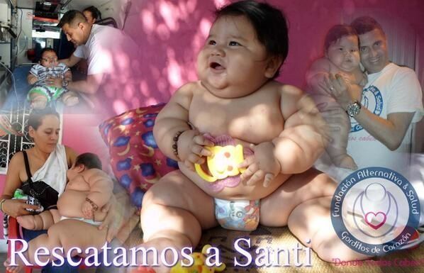 Colombia: Bebé obeso gana atención