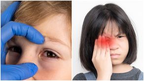 La conjuntivitis en niños: ¿Qué hacer y cómo tratarla?