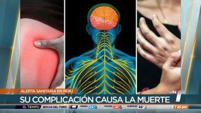 Panamá intensificado la vigilancia ante brote de síndrome de Guillain-Barré en Perú