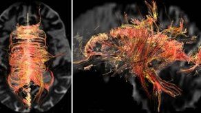 Desarrollan en EEUU tejido en 3D para estudiar heridas cerebrales
