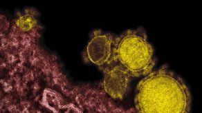 Aumentan muertes por virus respiratorio en A.Saudí