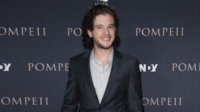 A Kit Harington le molesta que le pregunten por su pelo