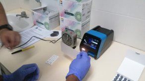 Moderno equipo para detectar casos de COVID-19 en Panamá.