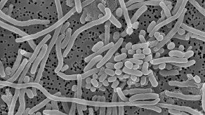 Un estudio señala que los desinfectantes no eliminan bacterias en hospitales