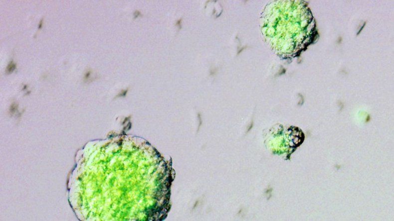 Autoridades de EEUU aprueban el uso de inhalador de insulina