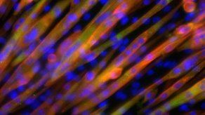 Colombia estudia nanoburbujas oxigenadas para optimizar función celular