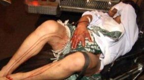 EEUU: 4 acusados de robar a hombre y cortarle pene