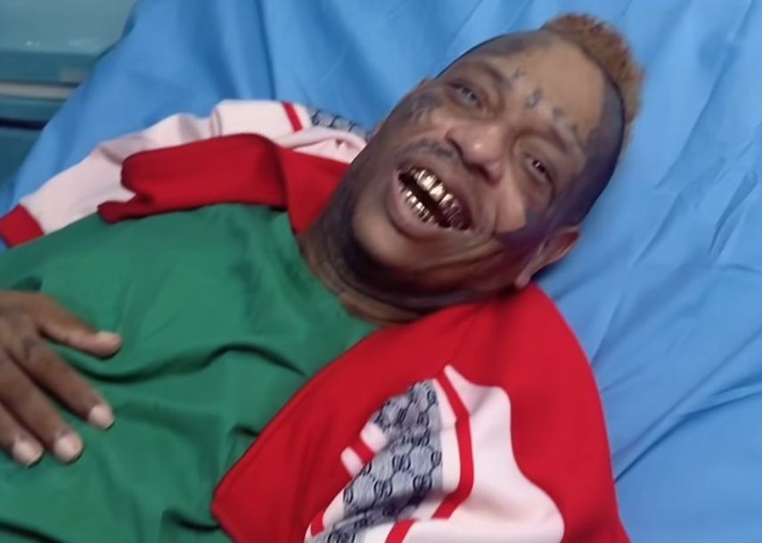 Amputan pierna a Japanese tras complicaciones de salud