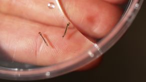 La fiebre amarilla está clasificada como una enfermedad hemorrágica causada por un virus transmitido por mosquitos.