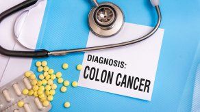 Microbiota sana disminuye riesgo de padecer enfermedades como cáncer de colon