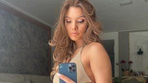 Lele Pons consigue la admiración de muchos al mostrarse sin filtros