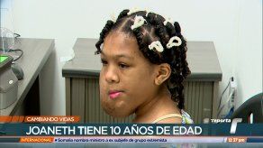 Cambiando vidas: Joaneth necesita ayuda para viajar a EE. UU. para realizarse una cirugía