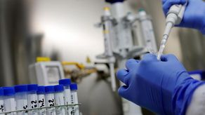 Los corregimientos con más casos de viruela del mono son Bella Vista, San Francisco y Río Abajo.