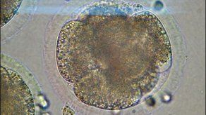 Científicos trazan esquema clave en lucha contra leucemia