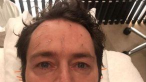 Howard Donald recurre a la acupuntura facial para dejar de comer compulsivamente