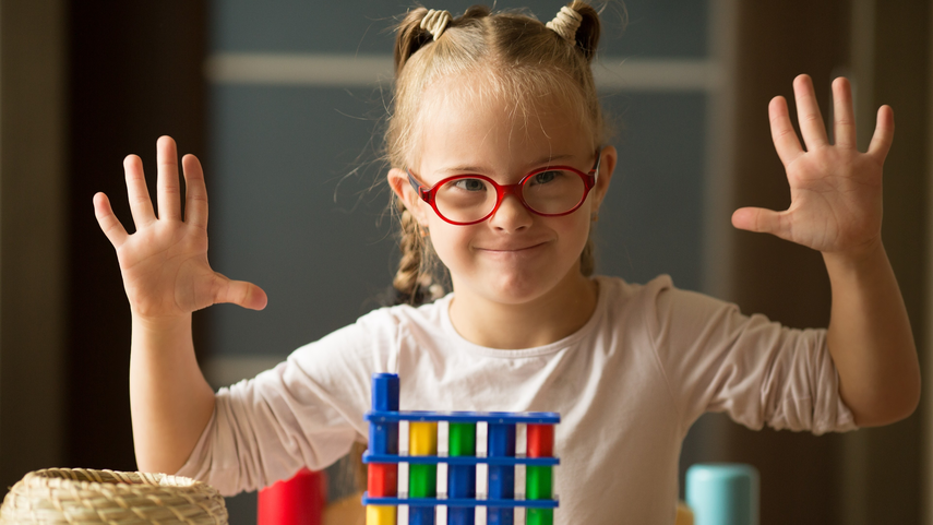 El Síndrome de Down no es una enfermedad, es resultado de una alteración genética y dura toda la vida. El Síndrome de Down no es una enfermedad, es resultado de una alteración genética y dura toda la vida.