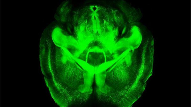 Cerebro humano consume mucha energía en infancia y retarda desarrollo físico