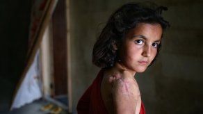 Siria: Matan a 20 combatientes progubernamentales