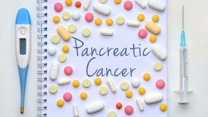 Científicos desarrollan nueva prueba de detección precoz del cáncer de páncreas