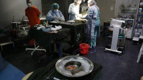 La cultura andina frustra trasplantes de órganos en Bolivia