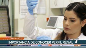 Cuida tu Salud: Trabajo de los laboratoristas