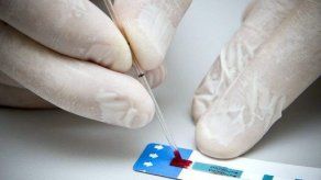 Estudio: Píldoras contra VIH previenen infección