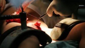 Un tribunal alemán condena la circuncisión por motivos religiosos