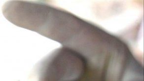 Brasileños descubren una molécula útil para tratar el mal de Chagas