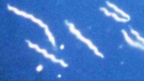 Una pomada antibiótica es eficaz contra enfermedad de Lyme