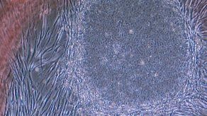 Desarrollan en Japón un tratamiento para el melanoma con células iPS