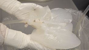 Si la FDA, por sus siglas en inglés) está de acuerdo, el experimento inicial se realizará fuera del cuerpo de un paciente.