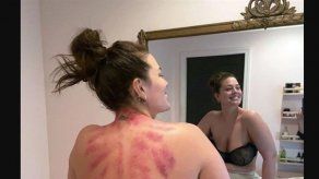 ¿Qué le ha pasado en la espalda a Ashley Graham?