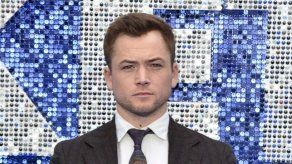 Taron Egerton temió seriamente quedarse calvo tras rodar Rocketman