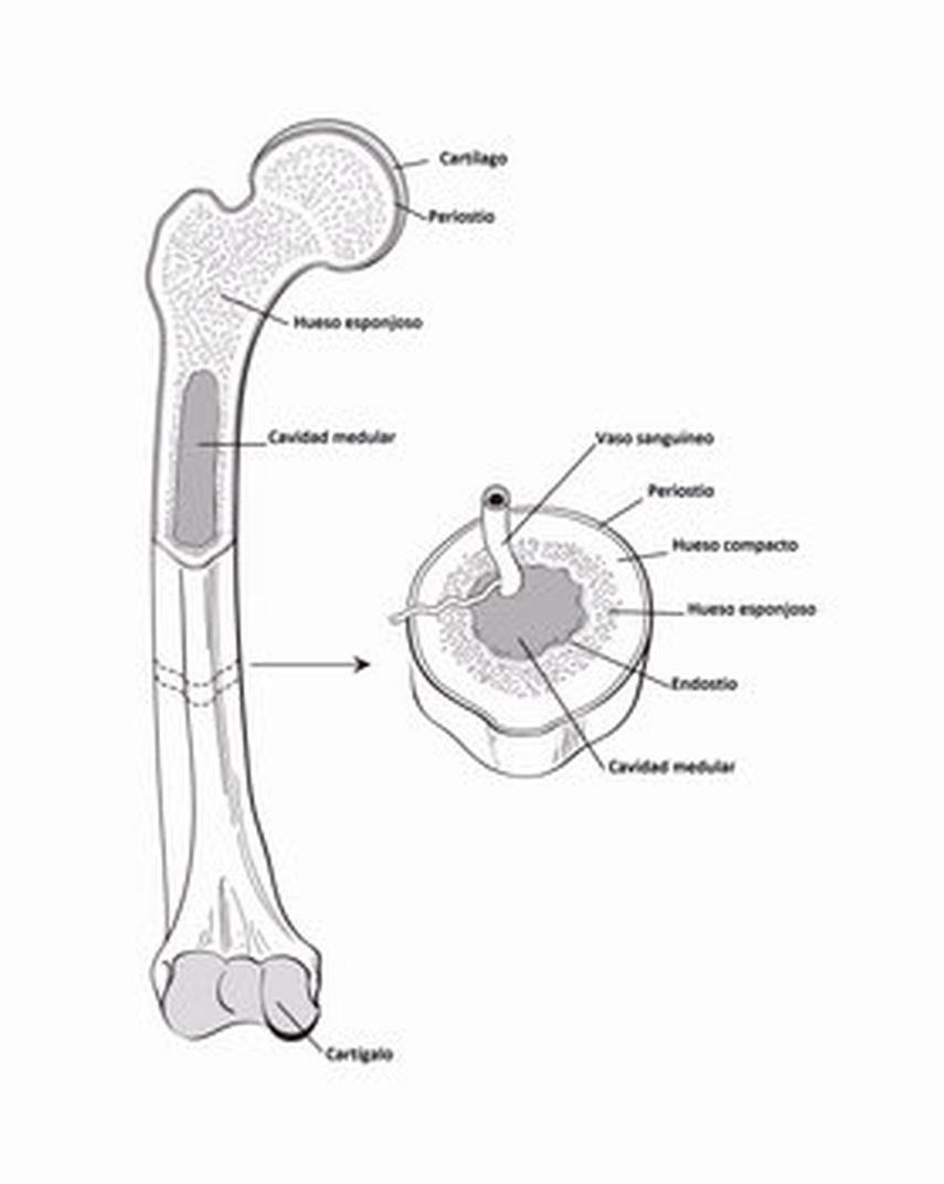 Ubicación del tipo de cáncer llamado osteosarcoma.