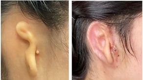 A las personas afectadas no se les desarrolla la oreja externa correctamente.