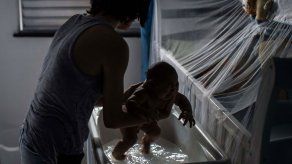 Descubren nuevas pistas sobre cómo el zika afecta al feto