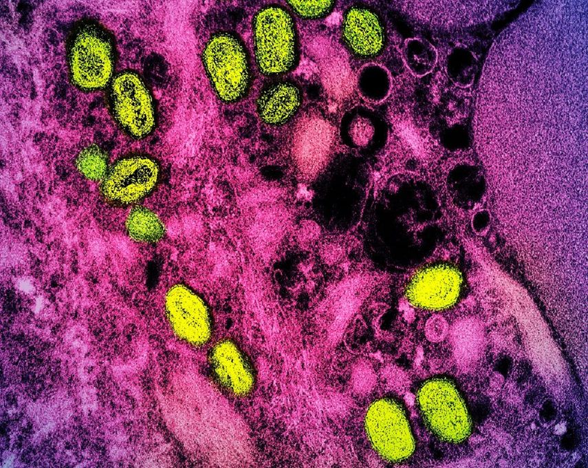 Virus de la viruela del mono.