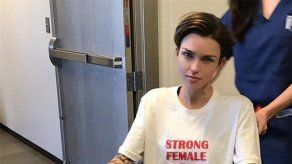 Ruby Rose se somete a una intervención de espalda