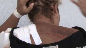 Mujer en Chiriquí casi muere tras machetazos