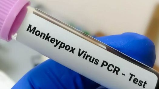 La viruela del mono puede afectar a todo el que tenga contacto físico cercano con una persona infectada, con sus ropas o sábanas.