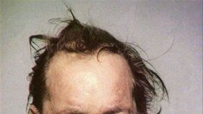 Hombre le dispara a podadora porque no funcionaba