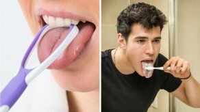 ¿Por qué es importante cepillarse la lengua?