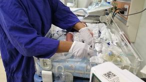 La CSS recibe 70 mil nacimientos al año y el 15% son prematuros.