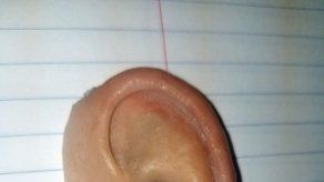 Florida encuentra al dueño de oreja prostética extraviada