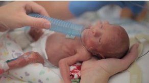 La historia del primer año de Ward