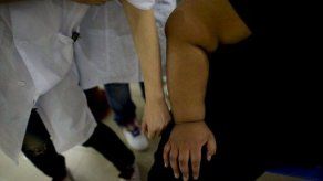 Descubren que una proteína ósea puede activar la quema de grasas