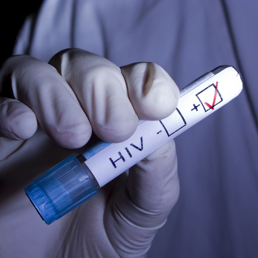 CSS advierte que nuevos casos de VIH se registran entre los 10 y 49 años