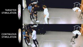 La estimulación eléctrica permite andar a tres personas con lesión medular