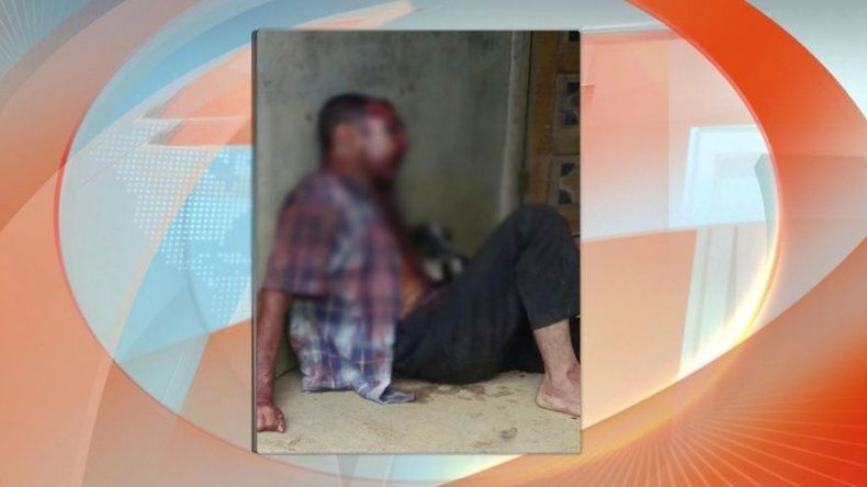 Hombre de 56 años es brutalmente golpeado en Los Pozos, delincuentes le robaron